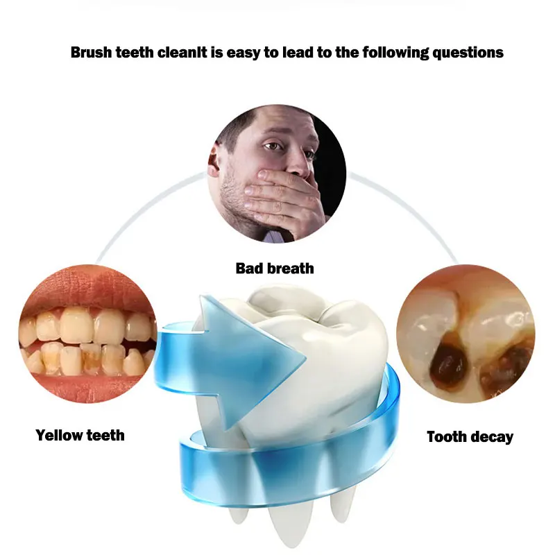 Cepillo de dientes tipo U, cabezal de silicona inteligente de 360 grados, cepillo de dientes eléctrico sónico, carga USB automática, resistente al agua - Imagen 6